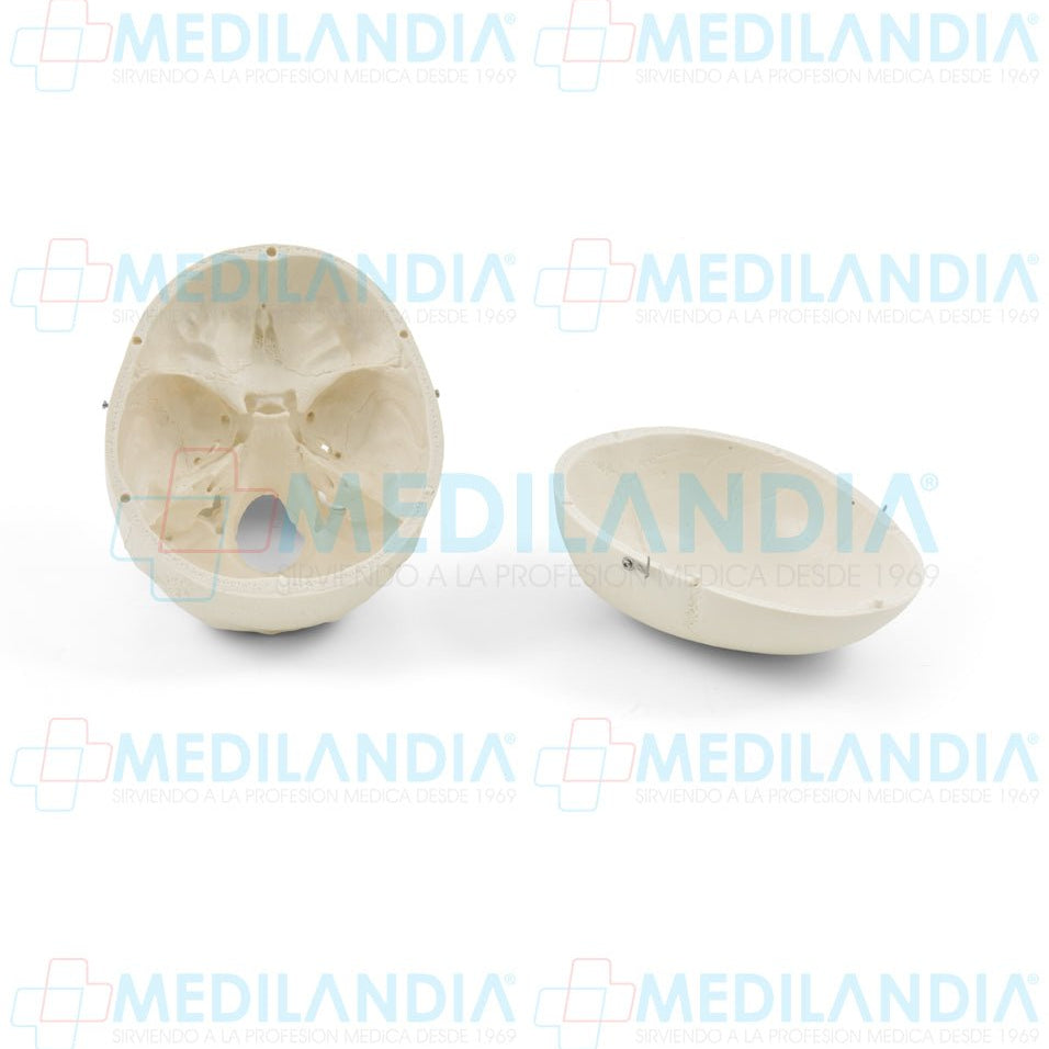 Craneo sin cerebro - Modelo anatomico - MEDILANDIA- MEDILANDIA | Tienda de productos y equipos médicos de calidad en México | Soluciones profesionales para clínicas, hospitales y consultorios.